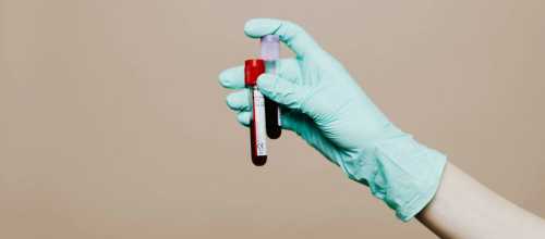 MethylScan's $20 Question: UCLA's Blood Test Turns Cancer Screening Into a Cost-Curve Story