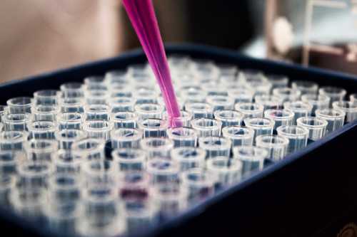 Postbiotic Supplement Containing 'Dead' Bacteria Boosts Natural GLP-1 and Curbs Weight Regain by 63%