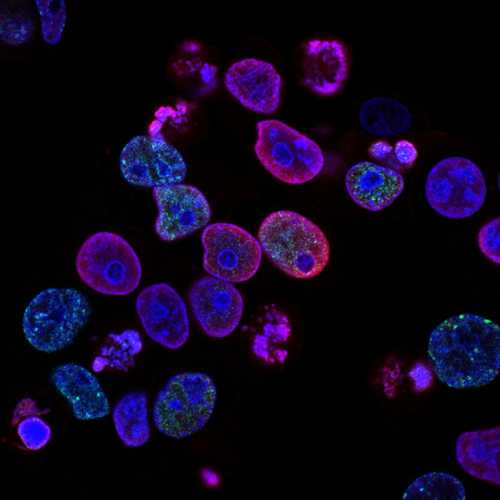 The 2026 Medical Research Fracture: Precision Breakthroughs Meet Systemic Collapse