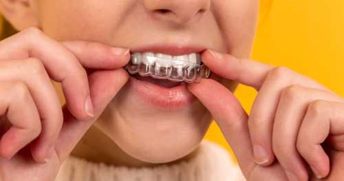 The Canadian Smile Shield: How the Federal Dental Care Plan is Expanding to Protect Low-Income and Vulnerable Citizens from Medical Debt