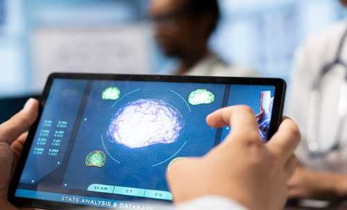 The UNC13A Signal: Miami Researchers Find the Missing Axis of Alzheimer's Decline