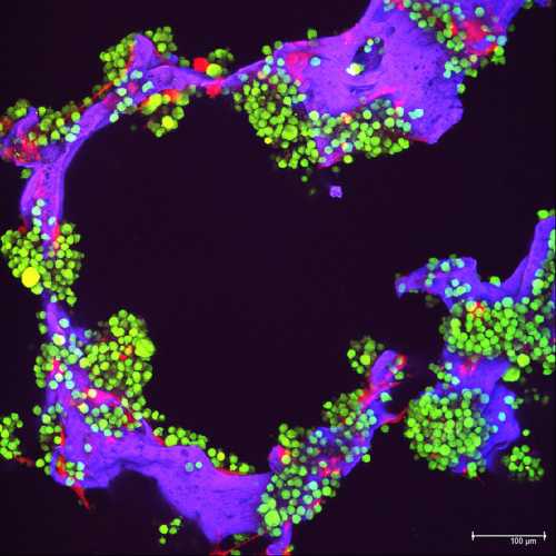 Zenbexus and the MRD Standard: How a 41-to-21 Ratio Rewrites the Myeloma Treatment Sequence